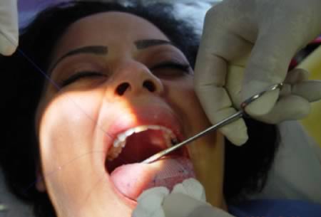 bolevoi plastir na yazik bolevoi plastir na yazik