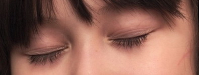 Гимнастика для глаз. Моргание Гимнастика для глаз. Моргание