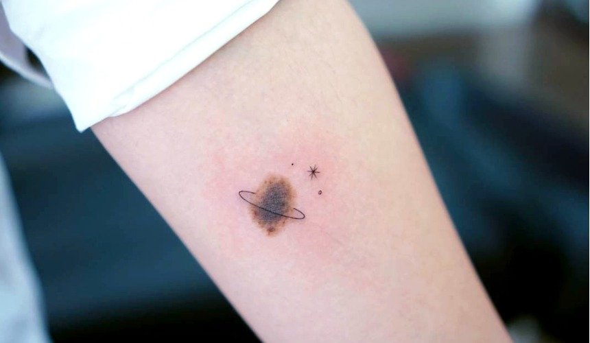 Татуировка поверх родинки 