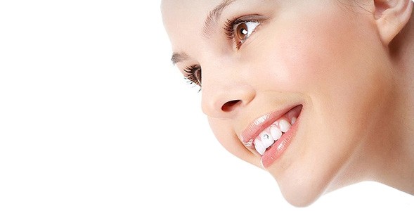 Установка скайса на зубы