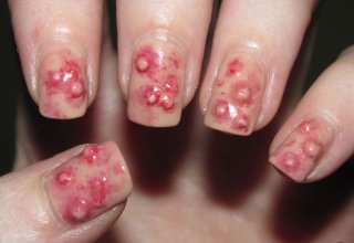 Вирус Вирус