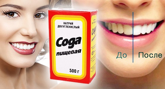 сода сода