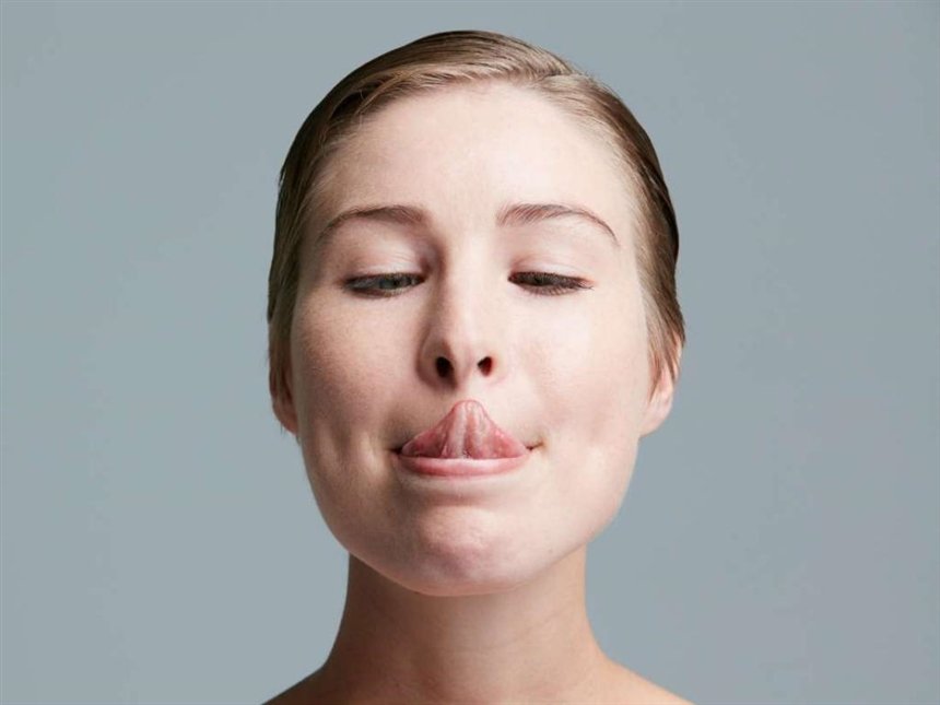 Проблема второго подбородка 