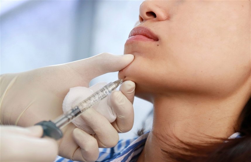 Проблема второго подбородка 