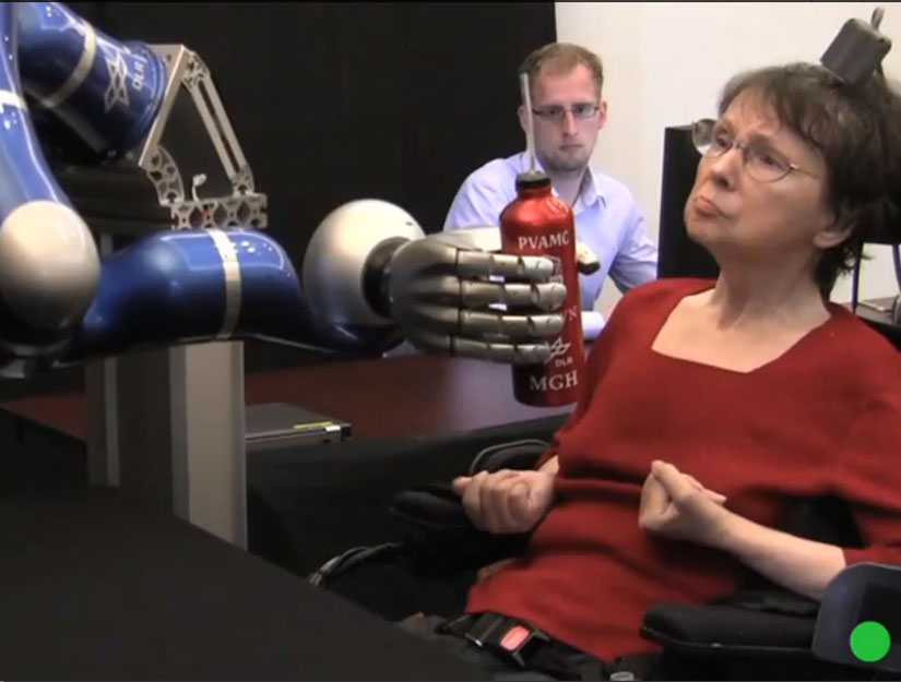 роботизированные конечности