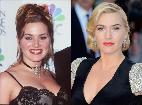 С годами только краше